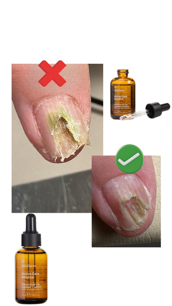 Краплі для догляду за нігтями та шкірою StraDerm, Active Care Solution, 30 мл E-111 фото