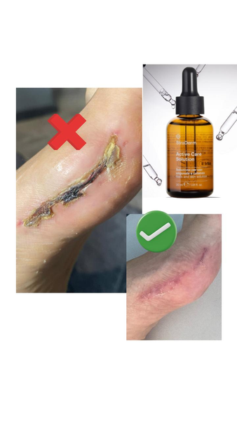 Краплі для догляду за нігтями та шкірою StraDerm, Active Care Solution, 30 мл E-111 фото