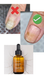 Краплі для догляду за нігтями та шкірою StraDerm, Active Care Solution, 30 мл E-111 фото 3