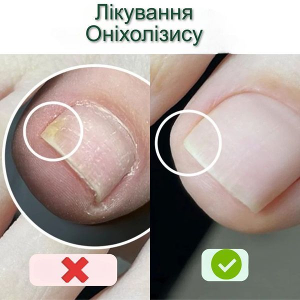 Краплі для догляду за нігтями та шкірою StraDerm, Active Care Solution, 30 мл E-111 фото